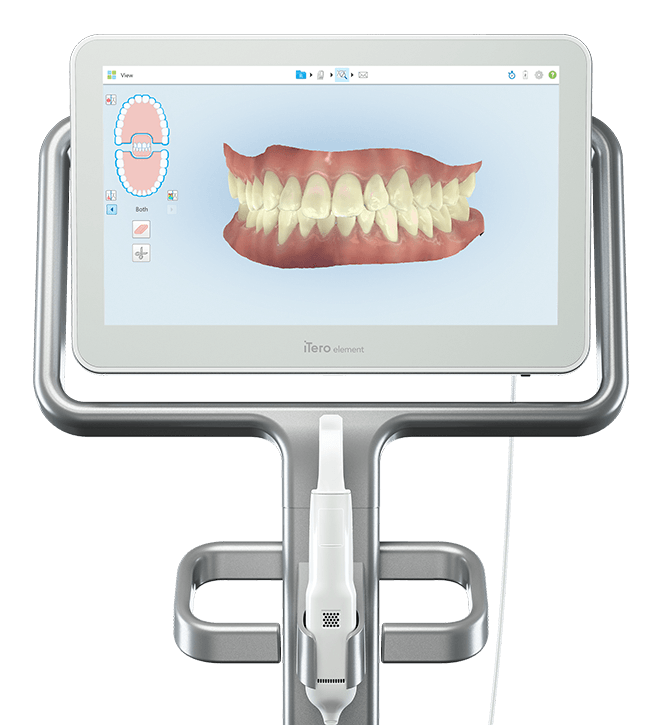 mejor clinica ortodoncia marbella