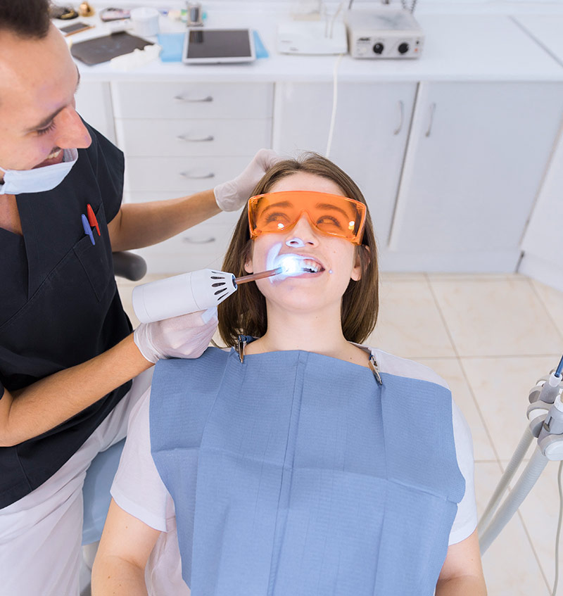 clinica dental blanqueamiento en marbella