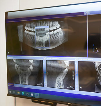 mejor clinica de implantes dentales en fuengirola