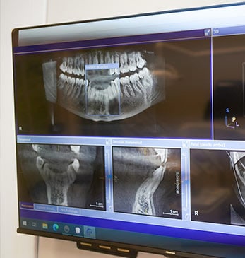 periodoncista en fuengirola